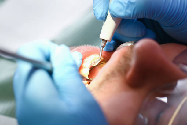 Tooth Infection Emergency Dentist in SC
