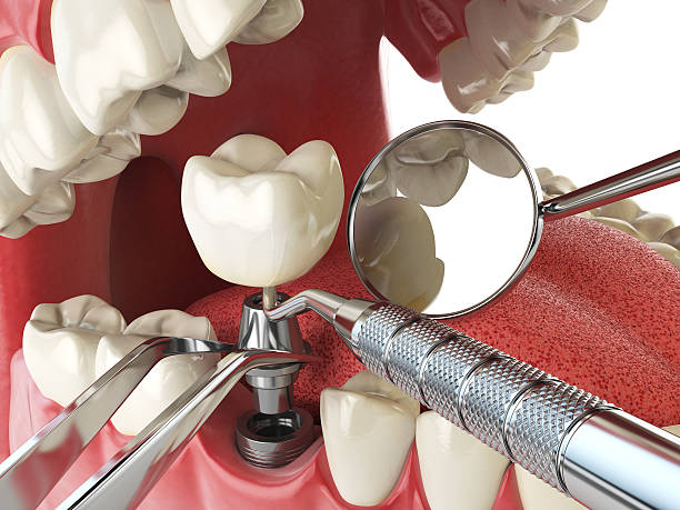 Best Urgent Tooth Repair  in Reidville, SC
